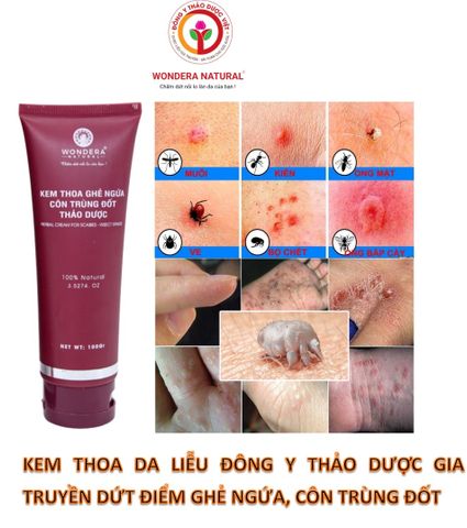  Kem thoa ghẻ ngứa côn trùng đốt thảo dược 100G 