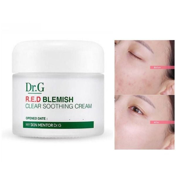 KEM DƯỠNG DR.G R.E.D BLEMISH CLEAR SOOTHING CREAM 70ML