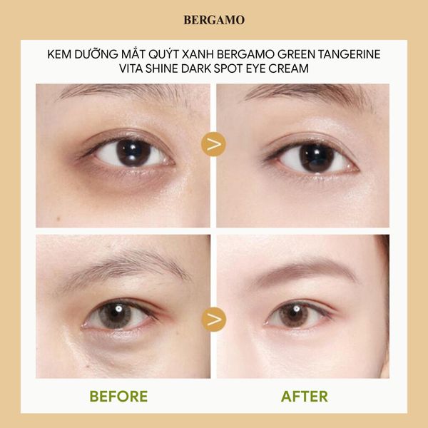 KEM DƯỠNG MẮT QUÝT XANH BERGAMO GREEN TANGERIN VITA SHINE DARK SPOT EYE CREAM 50G (TẶNG TUÝP 10ML)