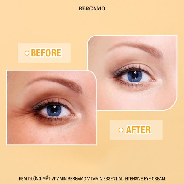 KEM DƯỠNG MẮT BERGAMO ESSENTIAL INTENSIVE EYECREAM 100ML