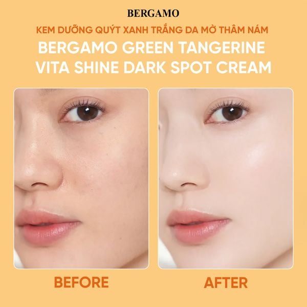 KEM DƯỠNG QUÝT XANH TRẮNG DA MỜ THÂM NÁM BERGAMO GREEN TANGERIN VITA SHINE DARK SPOT CREAM 50G