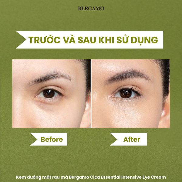 KEM DƯỠNG MẮT BERGAMO ESSENTIAL INTENSIVE EYECREAM 100G