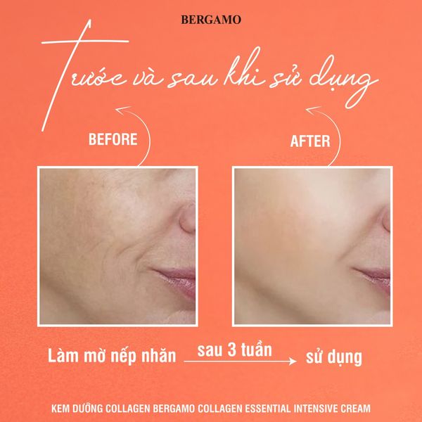 KEM DƯỠNG BERGAMO ESSENTIAL INTENSIVE CREAM 50G