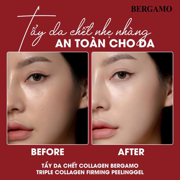 TẨY DA CHẾT COLLAGEN SĂN CHẮC BERGAMO TRIPLE COLLAGEN FIRMING PEELING GEL 150ML