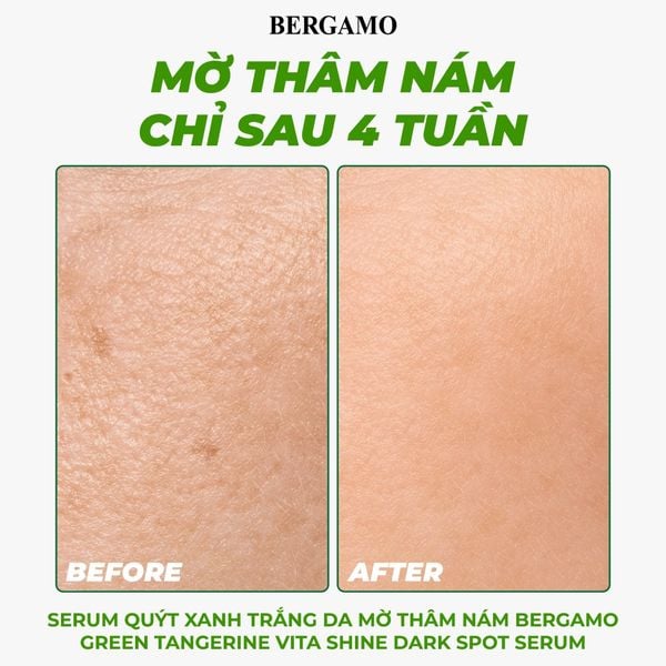 SERUM QUÝT XANH TRẮNG DA MỜ THÂM NÁM BERGAMO GREEN TANGERIN VITA SHINE DARK SPOT SERUM