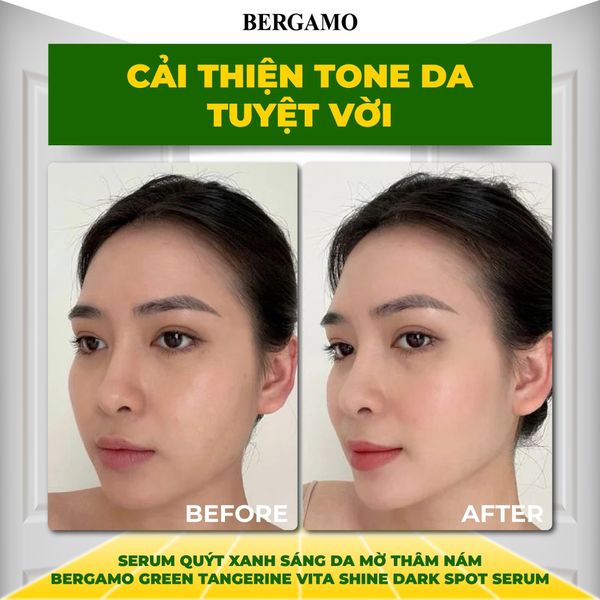 SERUM QUÝT XANH TRẮNG DA MỜ THÂM NÁM BERGAMO GREEN TANGERIN VITA SHINE DARK SPOT SERUM
