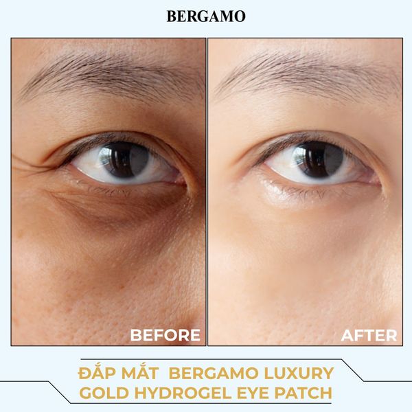 ĐẮP MẮT BERGAMO LUXURY GOLD HYDROGEL EYE PATCH (60PCS) 90G