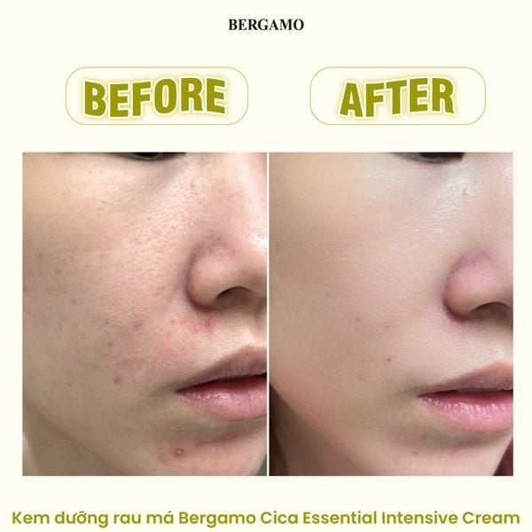 KEM DƯỠNG BERGAMO ESSENTIAL INTENSIVE CREAM 50G