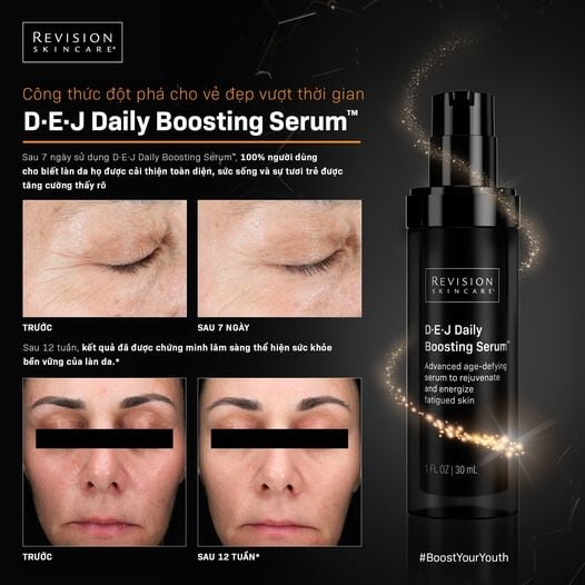 Revision Skincare D·E·J Daily Boosting - Serum Giúp Phục Hồi, Dưỡng Săn Chắc & Giảm Nếp Nhăn 30ml