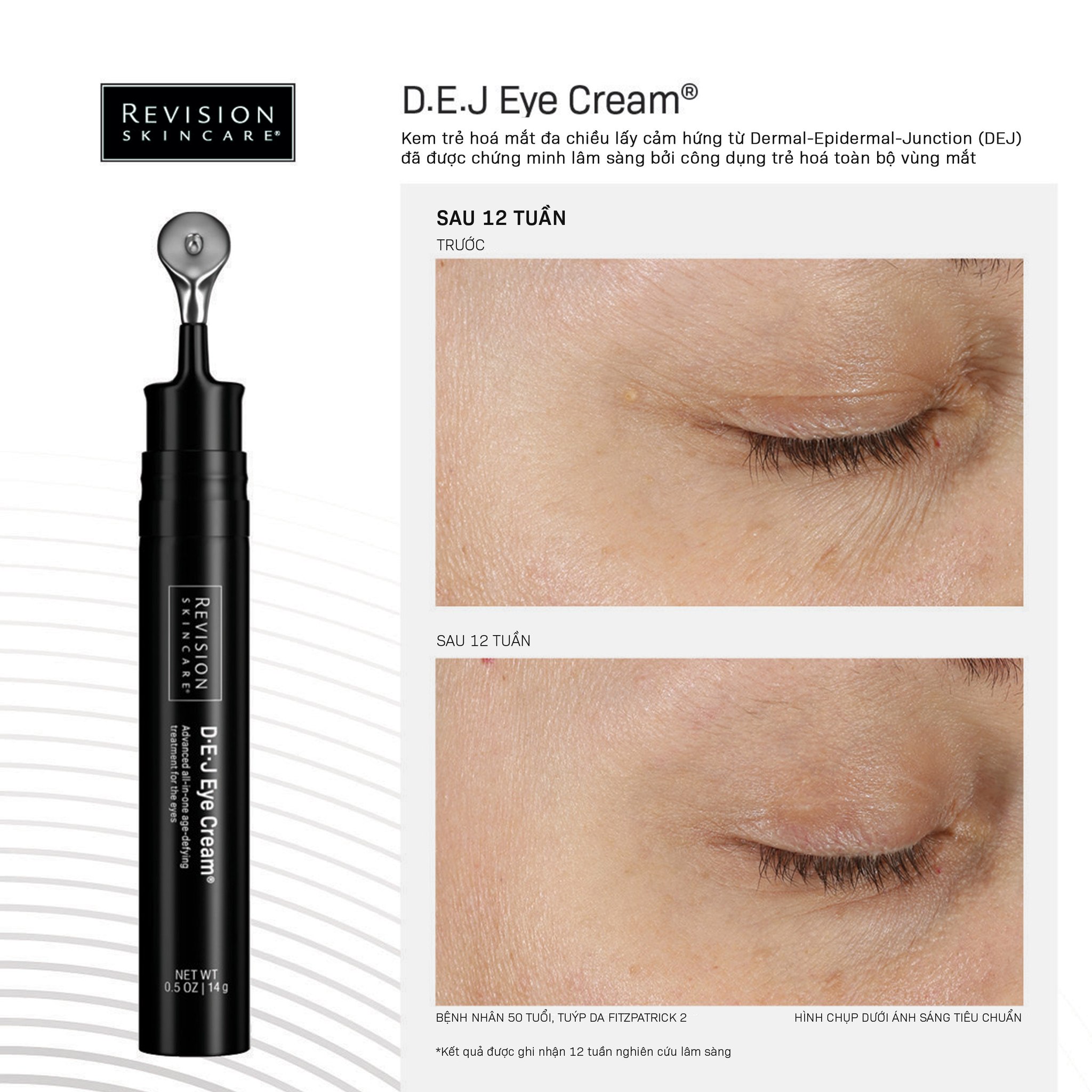 Revision Skincare D·E·J Eye Cream - Kem Mắt Dưỡng Sáng Và Hạn Chế Nếp Nhăn Cho Vùng Da Mắt