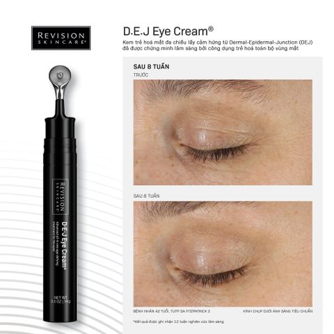 Revision Skincare D·E·J Eye Cream - Kem Mắt Dưỡng Sáng Và Hạn Chế Nếp Nhăn Cho Vùng Da Mắt