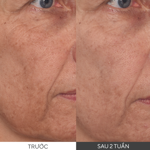 Murad Vita-C Glycolic Brightening Serum - Tinh chất sáng da