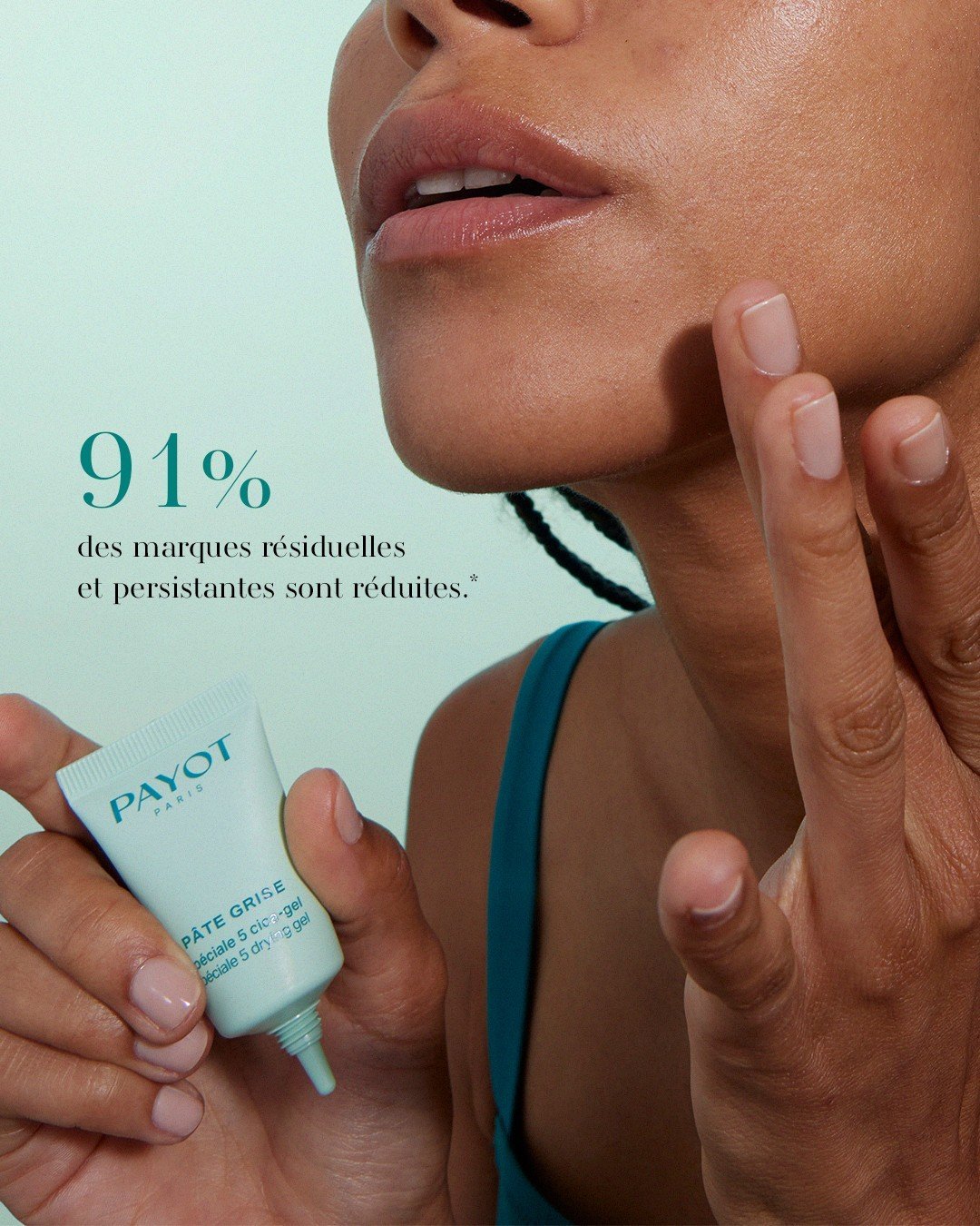 Gel chấm mụn PAYOT Pâte Grise Spécial 5 Drying Gel gom cồi ngừa thâm sẹo 15ml