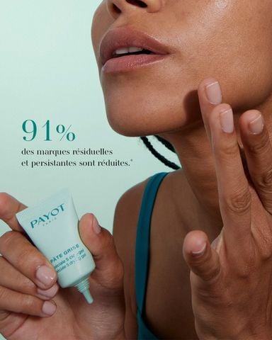Gel chấm mụn PAYOT Pâte Grise Spécial 5 Drying Gel gom cồi ngừa thâm sẹo 15ml