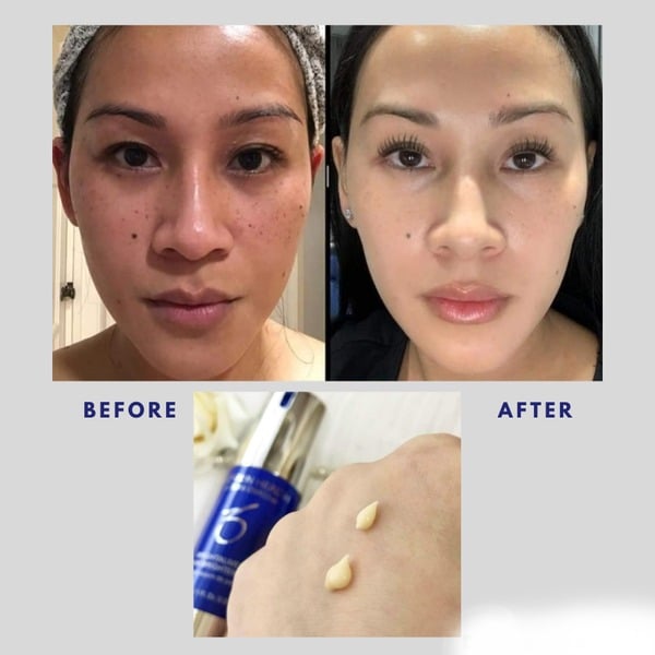 ZO SKIN HEALTH BRIGHTALIVE SKIN BRIGHTENER - KEM DƯỠNG SÁNG DA