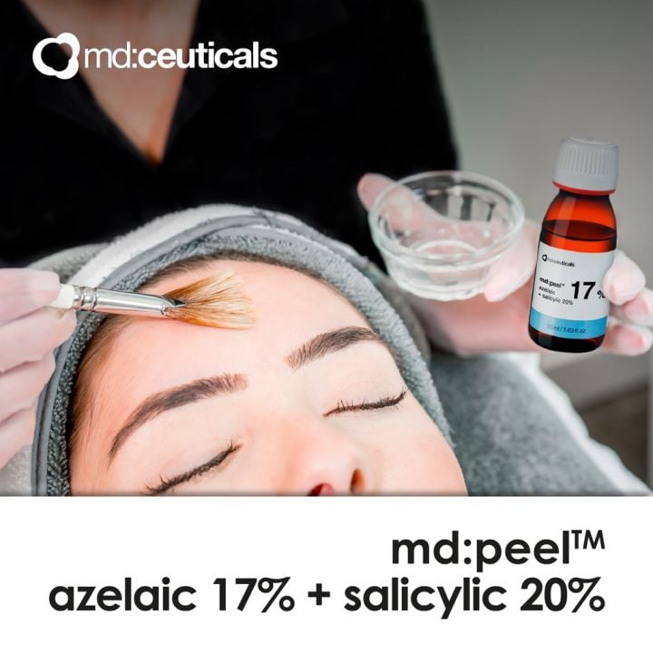 MD: PEEL AZELAIC 17% + SALICYLIC 20% - Thay da sinh học loại bỏ mụn cấp độ 1, 2 & làm sáng da