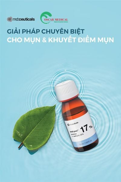 MD: PEEL AZELAIC 17% + SALICYLIC 20% - Thay da sinh học loại bỏ mụn cấp độ 1, 2 & làm sáng da