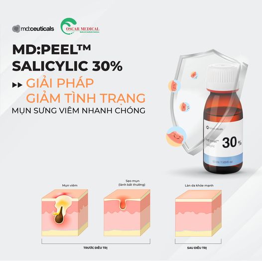 Md:ceuticals MD:PEEL & MD:PREPEEL - Thay da sinh học