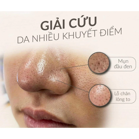 Christina Herbal Peel 4A - Mặt nạ thảo dược làm sạch sâu detox da