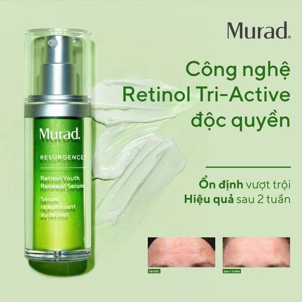 Murad Retinol Youth Renewal Serum - Tinh chất tái tạo trẻ hoá da