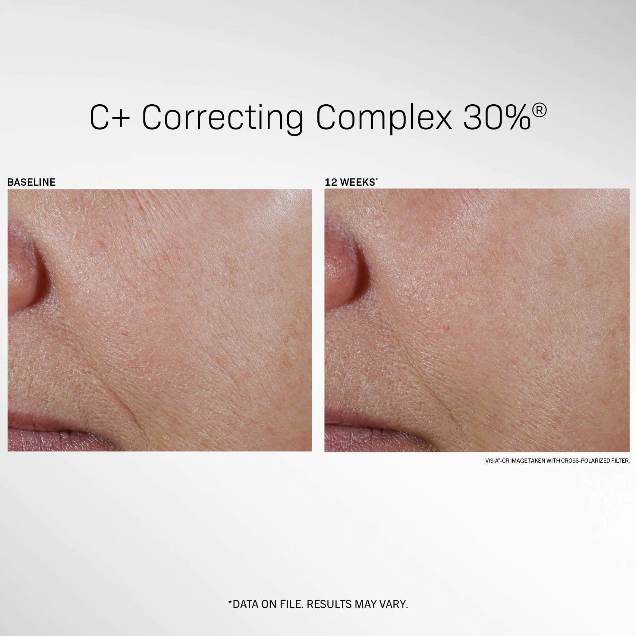 Revision Skincare C+ Correcting Complex 30% - Tinh chất Với Vitamin C 30% Giúp Sáng Mịn