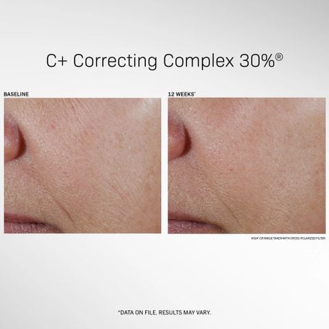 Revision Skincare C+ Correcting Complex 30% - Tinh chất Với Vitamin C 30% Giúp Sáng Mịn