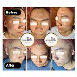  Serum Chăm Sóc Da Mụn Dưỡng Trắng Da Công Nghệ USA DR.LAVIC Anti Acne Serum Step 2 10ML - DR904 