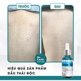  Dầu thải độc tố, giảm tiết bã nhờn, giảm sưng viêm Se Khít Lỗ Chân Lông Công Nghệ USA DR.LAVIC Detox - Oil 30ML - DR913M 