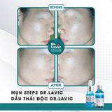  Dầu thải độc tố, giảm tiết bã nhờn, giảm sưng viêm Se Khít Lỗ Chân Lông Công Nghệ USA DR.LAVIC Detox - Oil 30ML - DR913M 