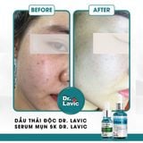  Dầu thải độc tố, giảm tiết bã nhờn, giảm sưng viêm Se Khít Lỗ Chân Lông Công Nghệ USA DR.LAVIC Detox - Oil 30ML - DR913M 