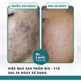  Serum Trị Mụn Chống Lão Hóa Công Nghệ USA DR.LAVIC BIO-Y10 Retinol Peptide Complex 15ML DR924 