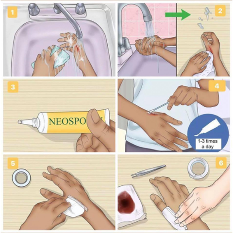  Kem mỡ hỗ trợ vết thương Neosporin 