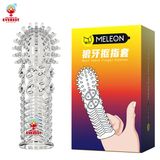 Bao cao su ngón tay đôn dên có gân gai 5 mẫu tự chọn 