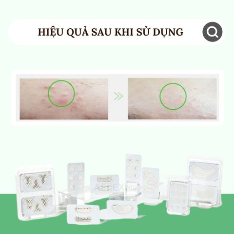  Miếng dán mụn kèm mặt nạ với miếng Magie thần kỳ LAPNPEOPLE tái tạo làm dịu da 