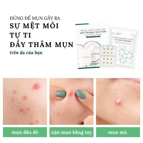  Miếng dán mụn kèm mặt nạ với miếng Magie thần kỳ LAPNPEOPLE tái tạo làm dịu da 