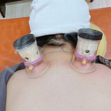  Bộ giác hơi ngải cứu cung đình 
