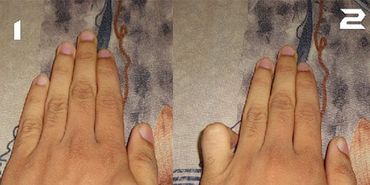 Tập gập ngón út đúng cách