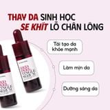  Tinh Chất Giúp Tái Tạo Da So Natural Việt Nam Red Peel Tingle Serum 