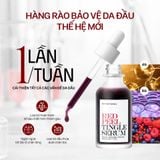 Tinh Chất Giúp Tái Tạo Da So Natural Việt Nam Red Peel Tingle Serum 
