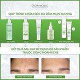  NORMACNE Anti-Imperfections Night Cream - Kem dưỡng ban đêm đa tác động dành cho da dầu, mụn 