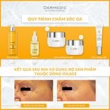  Kem mắt hỗ trợ tình trạng lão hoá mắt - OILAGE CONCENTRATED ANTI-WRINKLE EYE CREAM 15ML 
