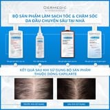  Tinh chất điều trị và kích thích mọc tóc - CAPILARTE SERUM TREATMENT STIMULATING HAIR GROWTH 