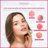  REDNESS Rosacea Prone Skin Anti-Ageing Night Cream - Kem dưỡng da nhạy cảm mẫn đỏ chống lão hóa ban đêm 
