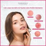  REDNESS Rosacea Prone Skin Correcting Day Cream UV + IR SPF20 - Kem ban ngày kèm SPF 20, giảm đỏ, giảm mao mạch 