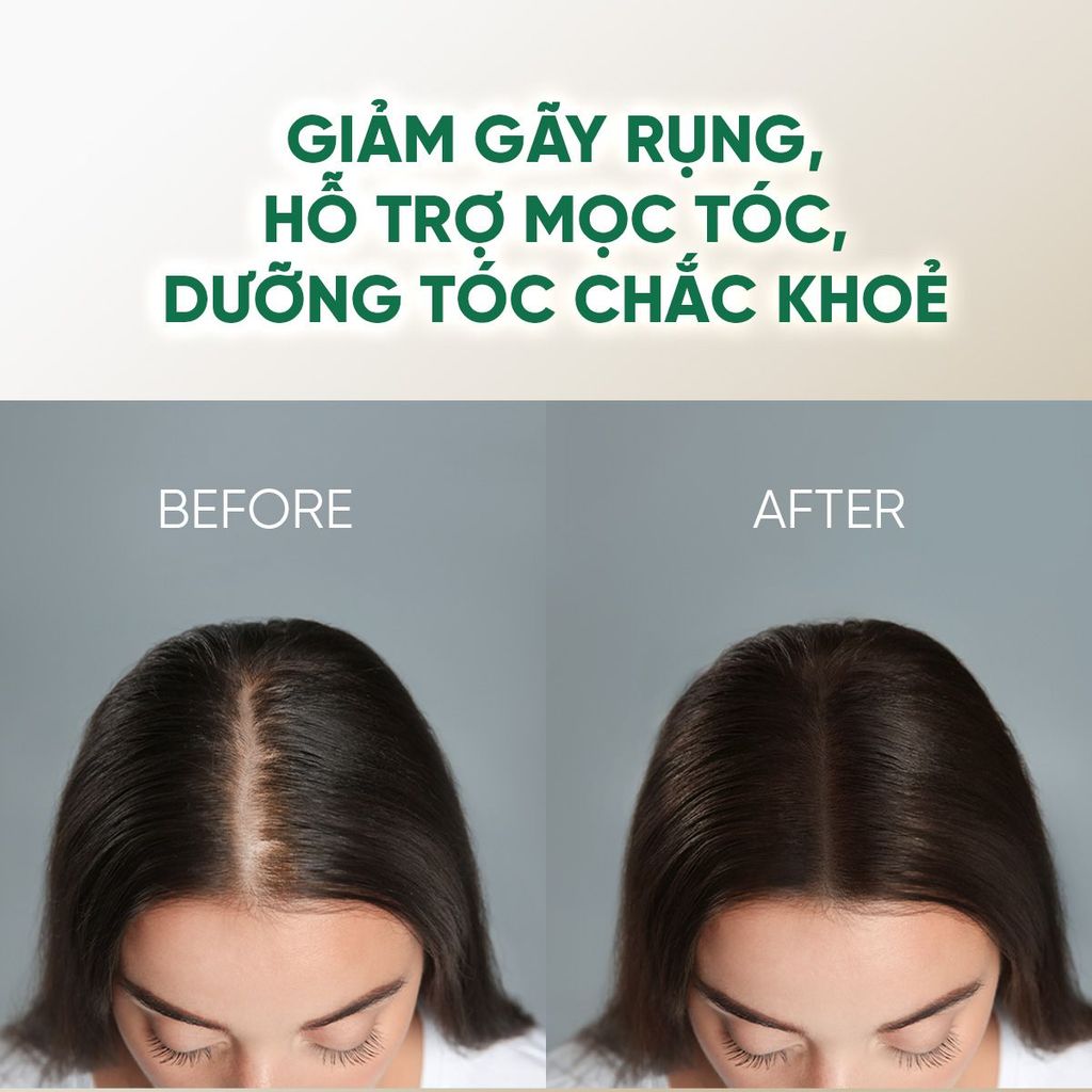 Dầu gội dưỡng tóc PURA D'OR Original Gold Label Anti - Hair Thinning Shampoo 473ml