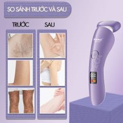 Máy tẩy lông Kemei KM-1539 chuyên dùng cạo lông toàn thân, bikini sử dụng pin sạc tiện lợi - Chính hãng