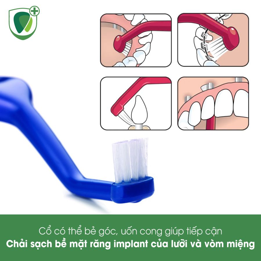 Bàn chải đánh răng đầu vòm dùng cho răng Implant Tepe Implant Care