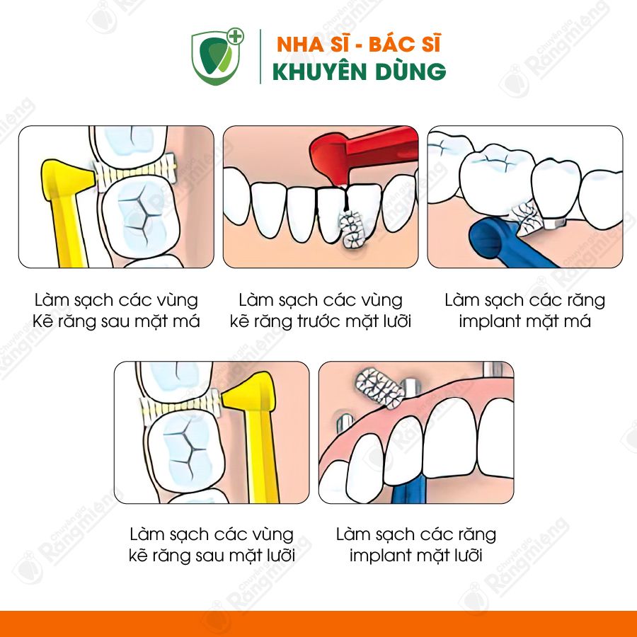 Bàn chải kẽ răng góc mix Tepe IDB Angle Mix