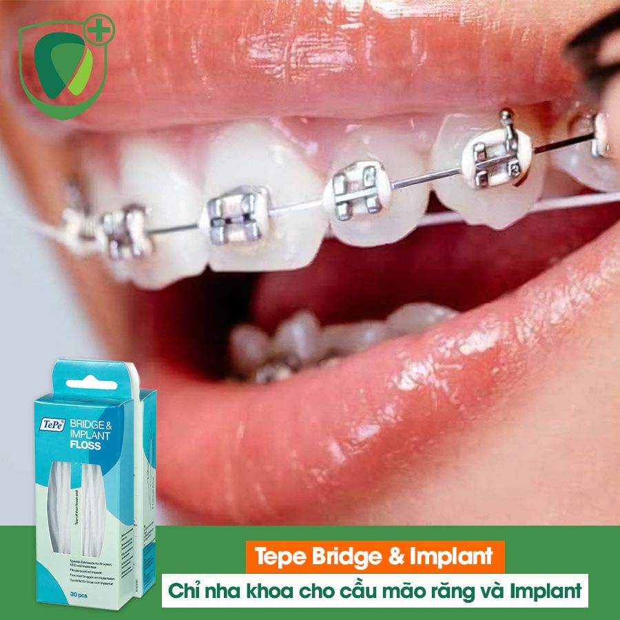 Chỉ nha khoa cho cầu mão răng và implant Tepe Bridge & Implant