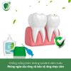 Gel Fluor và Chlorhexidine ngăn ngừa viêm nướu Tepe Gingival